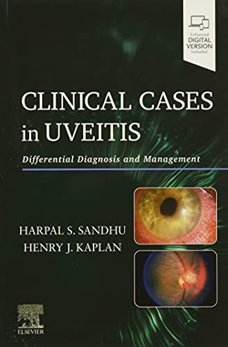 Clinical Cases in Uveitis: Differential Diagnosis and Management [Paperback] Sandhu, Harpal and Kaplan, Henry J.