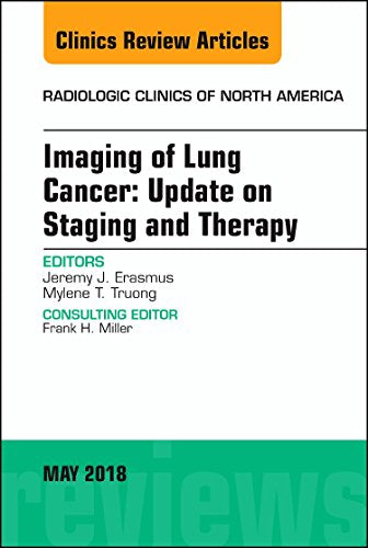 Lung Cancer, An Issue of Radiologic Clinics of North America (Volume 56-3) (The Clinics: Radiology, Volume 56-3) [Hardcover] Erasmus MD, Jeremy and Truong MD, Mylene T.