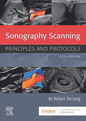 Sonography Scanning [Paperback] deJong RDMS  RDCS  RVT  FSDMS, M. Robert