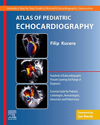 Atlas of Pediatric Echocardiography [Paperback] Kucera, Filip