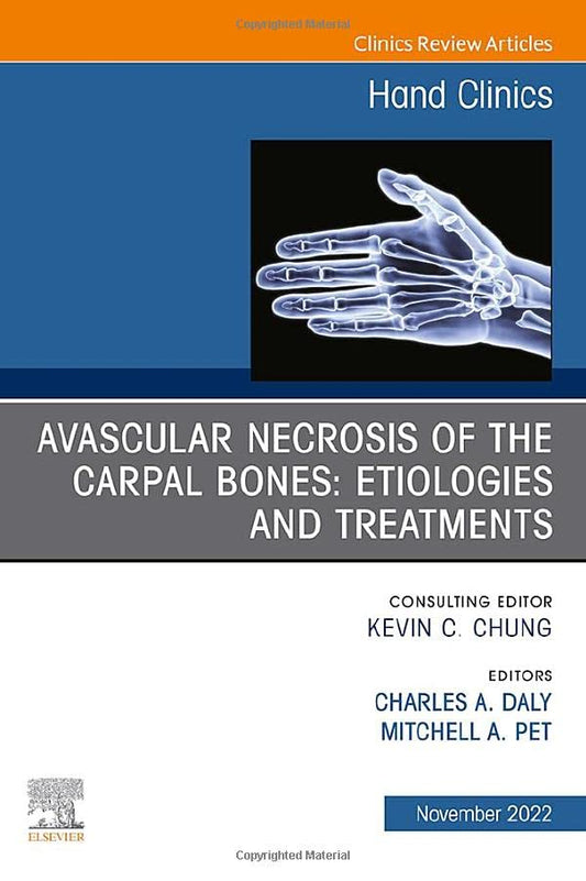 Avascular Necrosis of the Carpal Bones: Etiologies and Treatments, An Issue of Hand Clinics (Volume 38-4) (The Clinics: Internal Medicine, Volume 38-4) [Hardcover] Pet MD, Mitchell A.