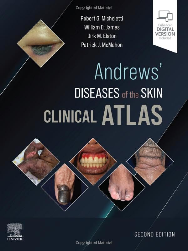 Andrews' Diseases of the Skin Clinical Atlas [Hardcover] Micheletti MD, Robert G.; James MD, William D.; Elston MD, Dirk M. and McMahon MD, Patrick J.