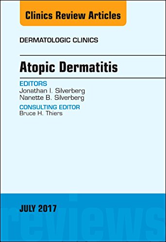 Atopic Dermatitis, An Issue of Dermatologic Clinics (Volume 35-3) (The Clinics: Dermatology, Volume 35-3) [Hardcover] Silverberg MD  PhD, Jonathan I. and Silverberg MD, Nanette B