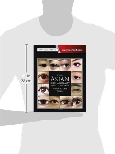 Asian Blepharoplasty and the Eyelid Crease, 3e