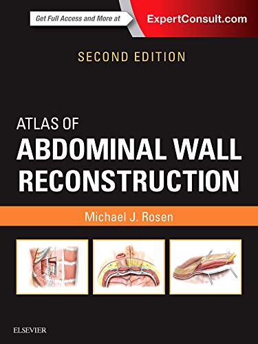 Atlas of Abdominal Wall Reconstruction: Expert Consult - Online and Print [Hardcover] Rosen MD  FACS, Michael J.