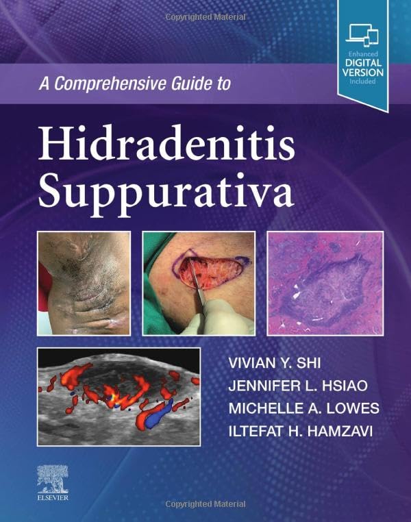 A Comprehensive Guide to Hidradenitis Suppurativa [Hardcover] Shi MD, Vivian Y.; Hsiao MD, Jennifer L.; Lowes MD  PhD, Michelle A. and Hamzavi MD, Iltefat H.