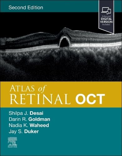 Atlas of Retinal OCT: Optical Coherence Tomography [Hardcover] Duker MD, Jay S.; Waheed MD MPH, Nadia K.; Goldman MD, Darin and Desai MD, Shilpa J.