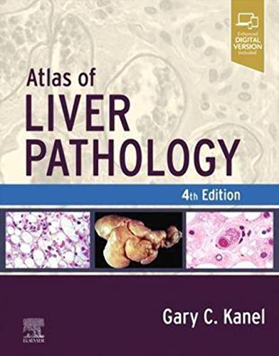 Atlas of Liver Pathology (Atlas of Surgical Pathology) [Hardcover] Kanel MD, Gary C.