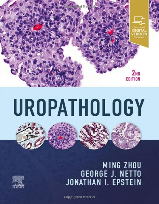 Uropathology [Hardcover] Zhou MD  PhD, Ming; Netto MD, George and Epstein, Jonathan I