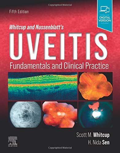 Whitcup and Nussenblatt's Uveitis: Fundamentals and Clinical Practice [Hardcover] Whitcup MD, Scott M. and Sen, H. Nida