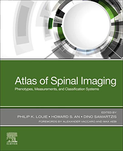 Atlas of Spinal Imaging: Phenotypes, Measurements and Classification Systems [Paperback] Louie MD, Philip K.; An MD, Howard S. and Samartzis, Dino