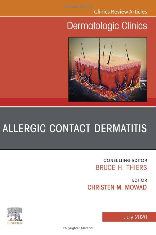 Allergic Contact Dermatitis,An Issue of Dermatologic Clinics (Volume 38-3) (The Clinics: Dermatology, Volume 38-3) [Hardcover] Mowad, Christen M.