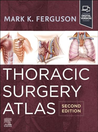 Thoracic Surgery Atlas [Hardcover] Ferguson MD, Mark K.