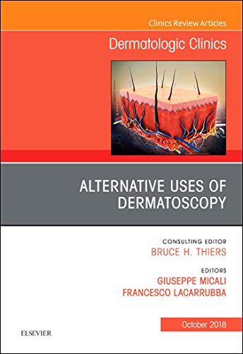 Alternative Uses of Dermatoscopy, An Issue of Dermatologic Clinics (Volume 36-4) (The Clinics: Dermatology, Volume 36-4) [Hardcover] Micali, Giuseppe and Lacarrubba, Francesco