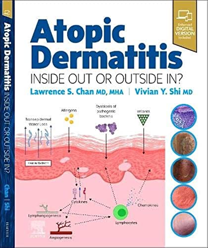 Atopic Dermatitis: Inside Out or Outside In [Hardcover] Chan MD.  MHA, Lawrence S and Shi MD, Vivian Y.