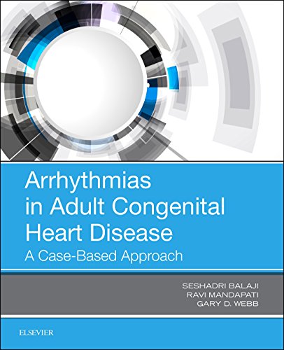 Arrhythmias in Adult Congenital Heart Disease: A Case-Based Approach [Paperback] Balaji MBBS  MRCP (UK)  PhD, Seshadri; Mandapati MD, Ravi and Webb MD, Gary