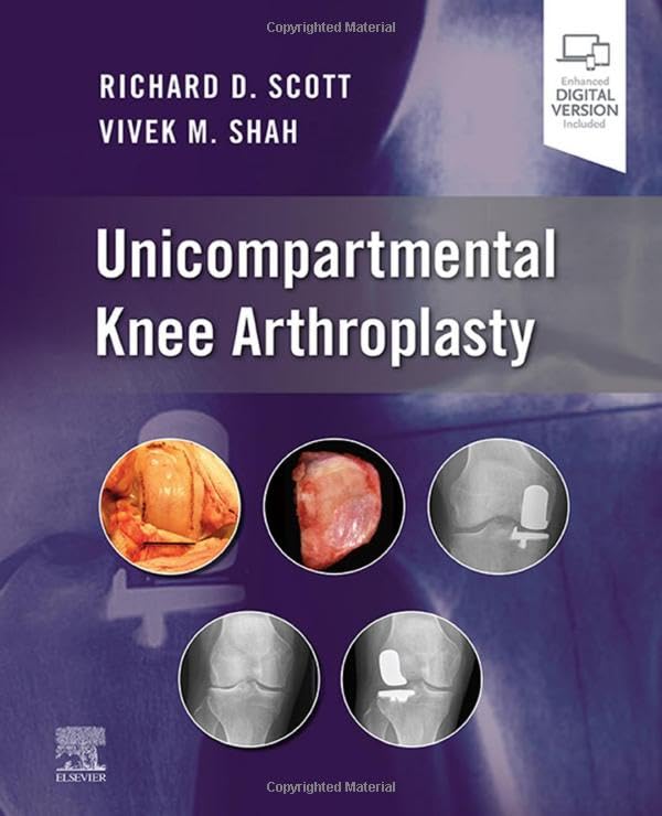 Unicompartmental Knee Arthroplasty [Hardcover] Scott, Richard D. and Shah, Vivek