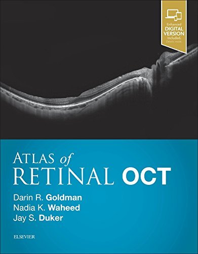 Atlas of Retinal OCT: Optical Coherence Tomography [Hardcover] Goldman MD, Darin; Waheed MD MPH, Nadia K. and Duker MD, Jay S.