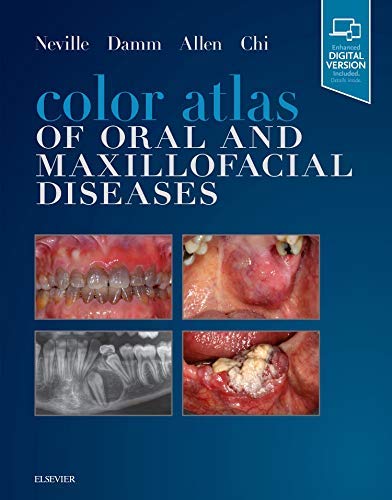 Color Atlas of Oral and Maxillofacial Diseases [Hardcover] Neville DDS, Brad W.; Damm DDS, Douglas D.; Allen DDS  MSD, Carl M. and Chi DMD, Angela C.