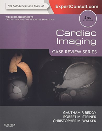 Cardiac Imaging: Case Review Series: Case Review Series [Paperback] Reddy MD  MPH, Gautham P.; Steiner MD, Robert M. and Walker MD, Christopher M.