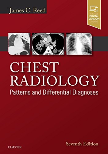 Chest Radiology: Patterns and Differential Diagnoses [Hardcover] Reed MD, James C.