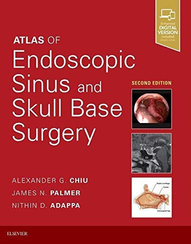 Atlas of Endoscopic Sinus and Skull Base Surgery [Hardcover] Adappa MD, Nithin D; Palmer MD, James N. and Chiu MD, Alexander G.