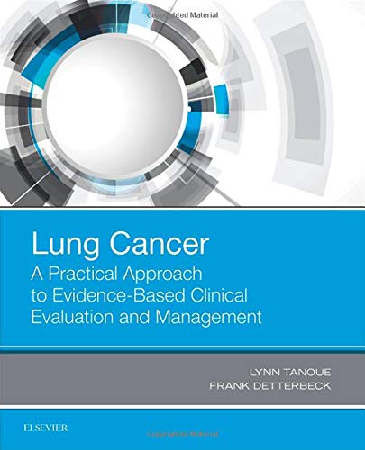 Lung Cancer: A Practical Approach to Evidence-Based Clinical Evaluation and Management [Paperback] Tanoue MD, Lynn T. and Detterbeck MD  FACS  FCCP, Frank C