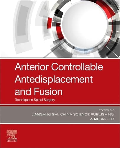 Anterior Controllable Antedisplacement and Fusion: Technique in Spinal Surgery [Paperback] China Science Publishing & Media Ltd and Shi, Jiangang