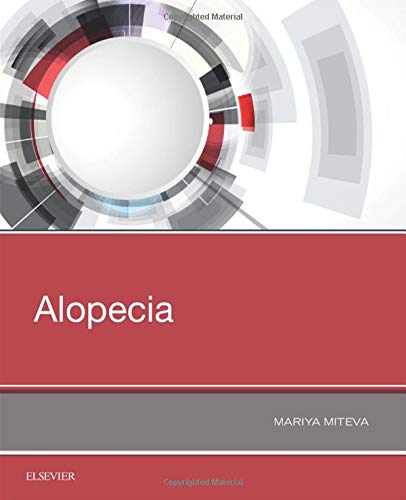 Alopecia [Paperback] Miteva, Mariya I