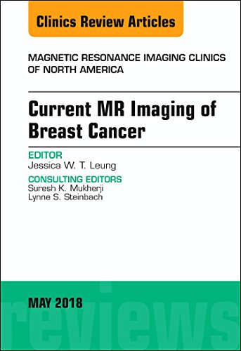 Current MR Imaging of Breast Cancer, An Issue of Magnetic Resonance Imaging Clinics of North America (Volume 26-2) (The Clinics: Radiology, Volume 26-2) [Hardcover] Leung MD  FACR, Jessica W. T.