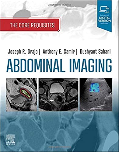 Abdominal Imaging: The Core Requisites [Paperback] Grajo, Joseph R.; Sahani MD, Dushyant V and Samir MD  MPH, Anthony E